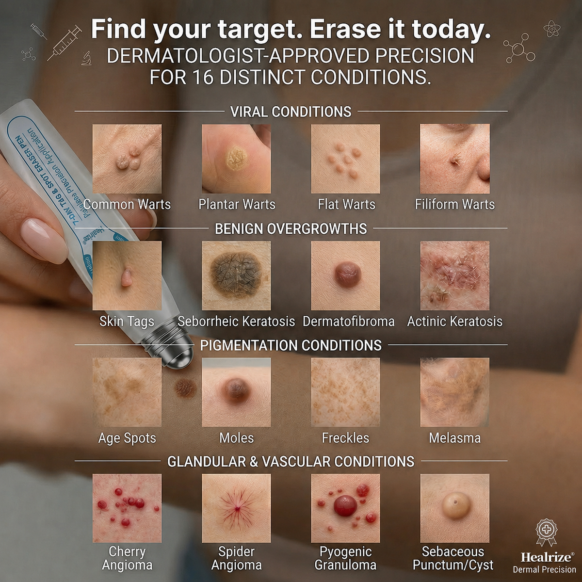 𝐇e𝐚𝐥𝐫i𝐳e® 7-𝐷𝑎𝑦 𝗧𝐚𝐠 & 𝗦𝗽𝐨𝐭 𝐄𝐫𝒂𝒔𝒆𝒓(Zero Pain, Zero 𝐒𝐜𝐚𝒓𝒔 Rollerball)💪